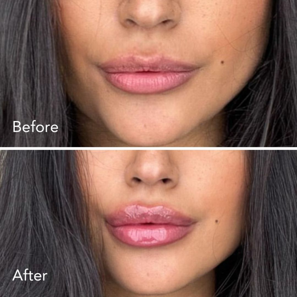 FullBloom™ | Lip Plumper