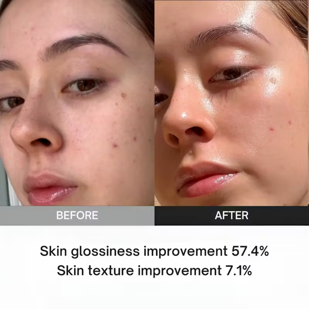 Dermax™ | Booster Facial Therapy