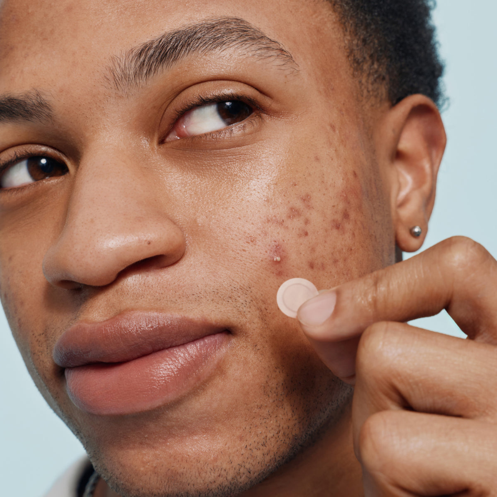 ClearDot™ | Invisible Pimple Patch