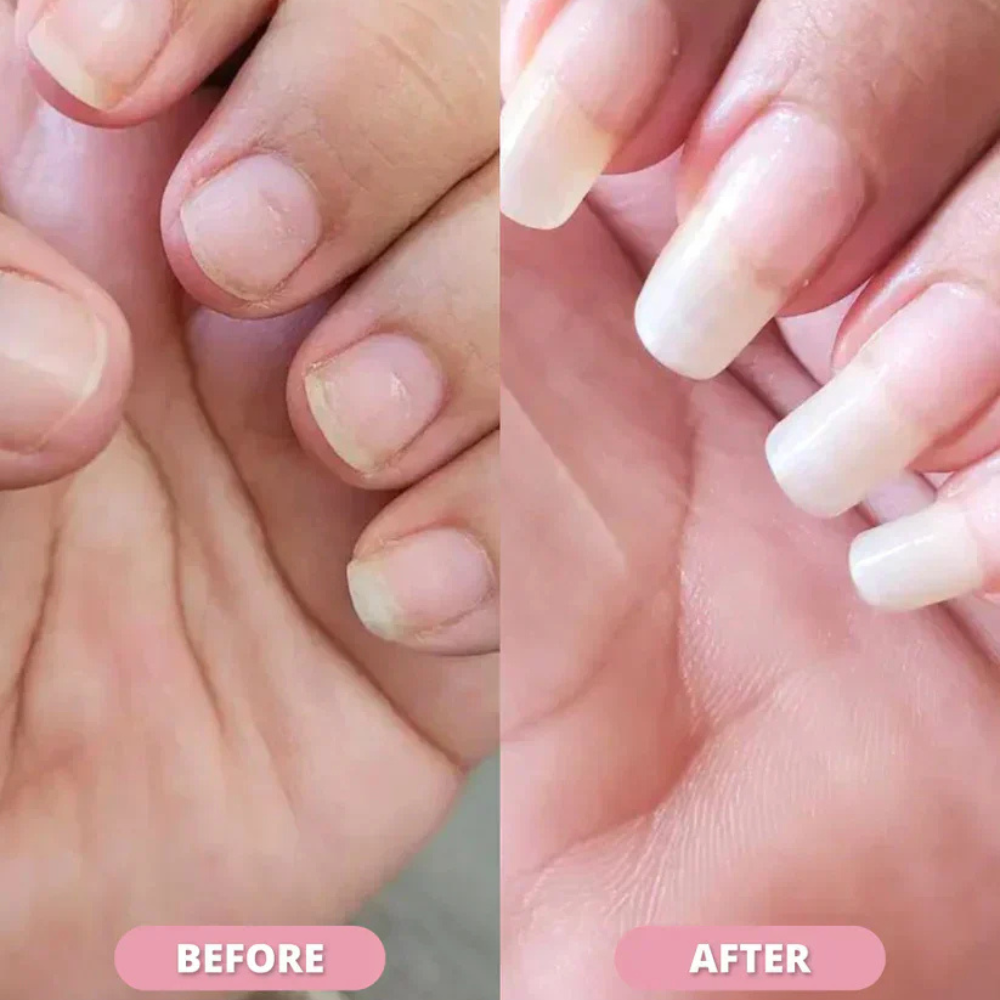 CutieCare™ | Nail Oil Repair