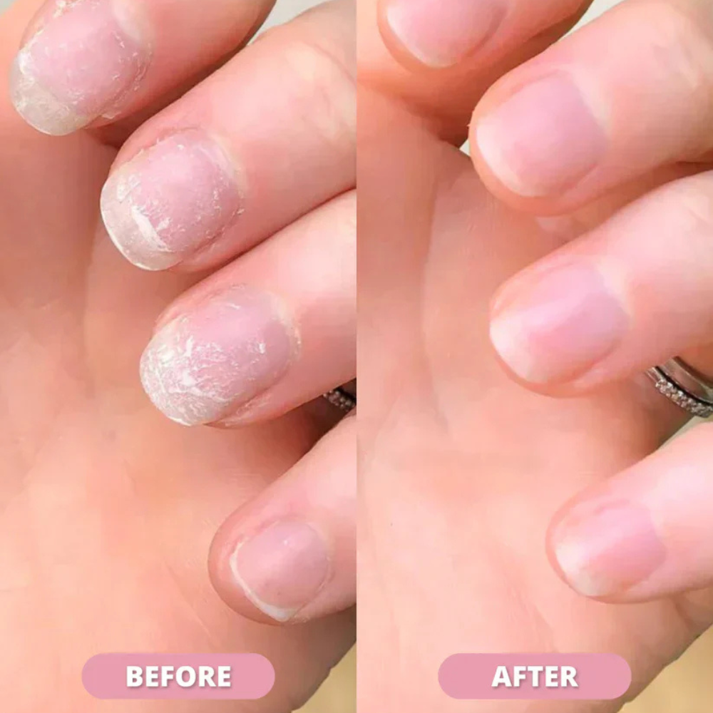 CutieCare™ | Nail Oil Repair