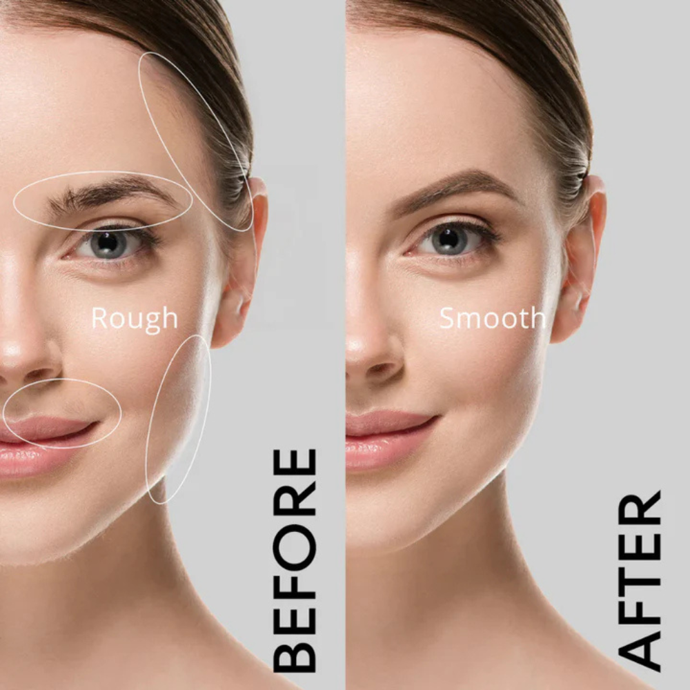 Silvelle™ | Facial Hair Remover
