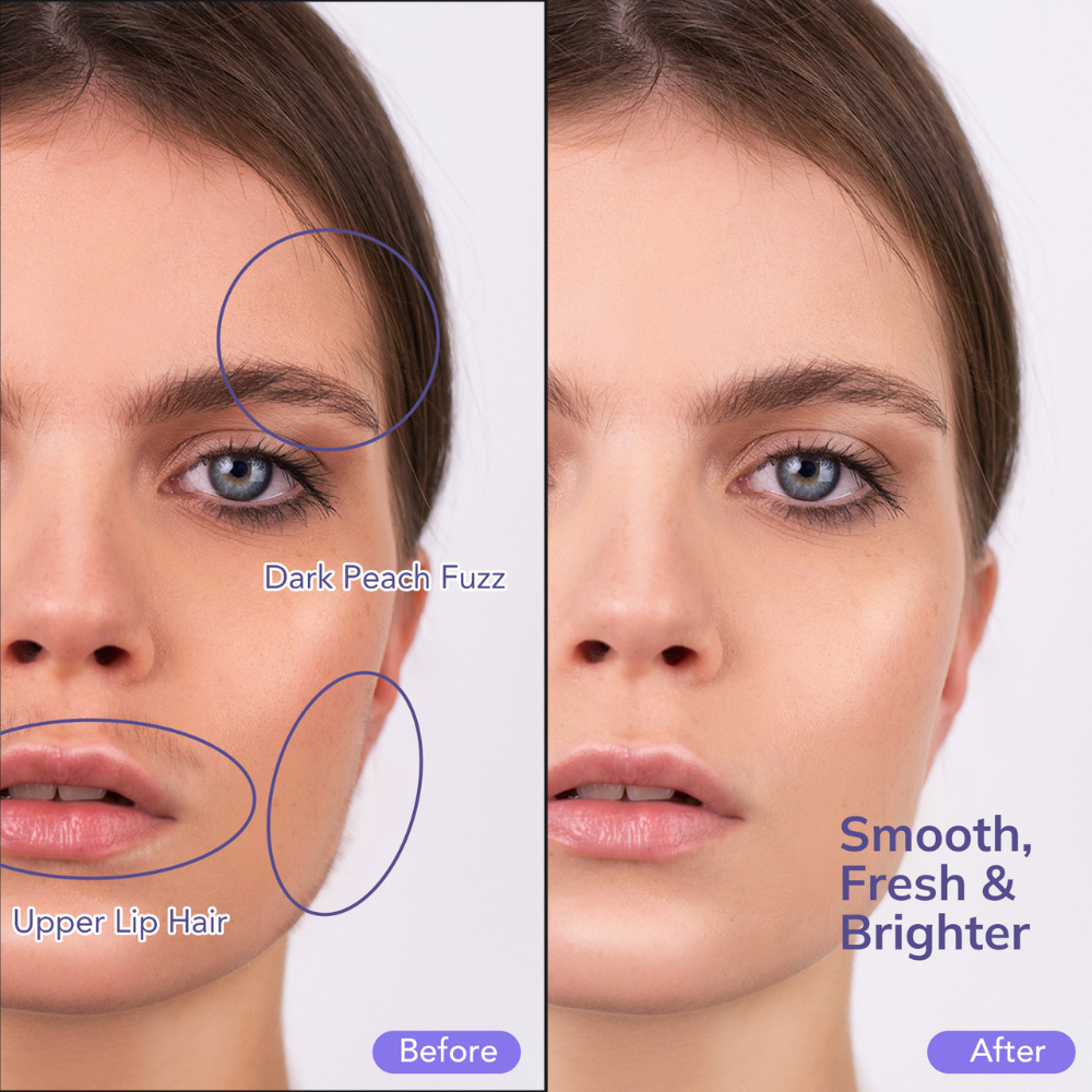 Dermexa™ | Sonic Dermaplaning Tool