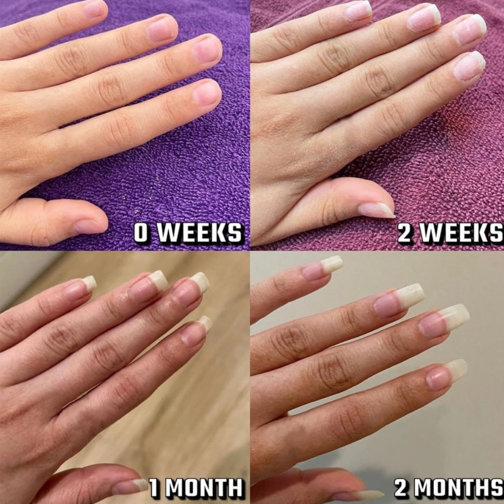 CutieCare™ | Nail Oil Repair