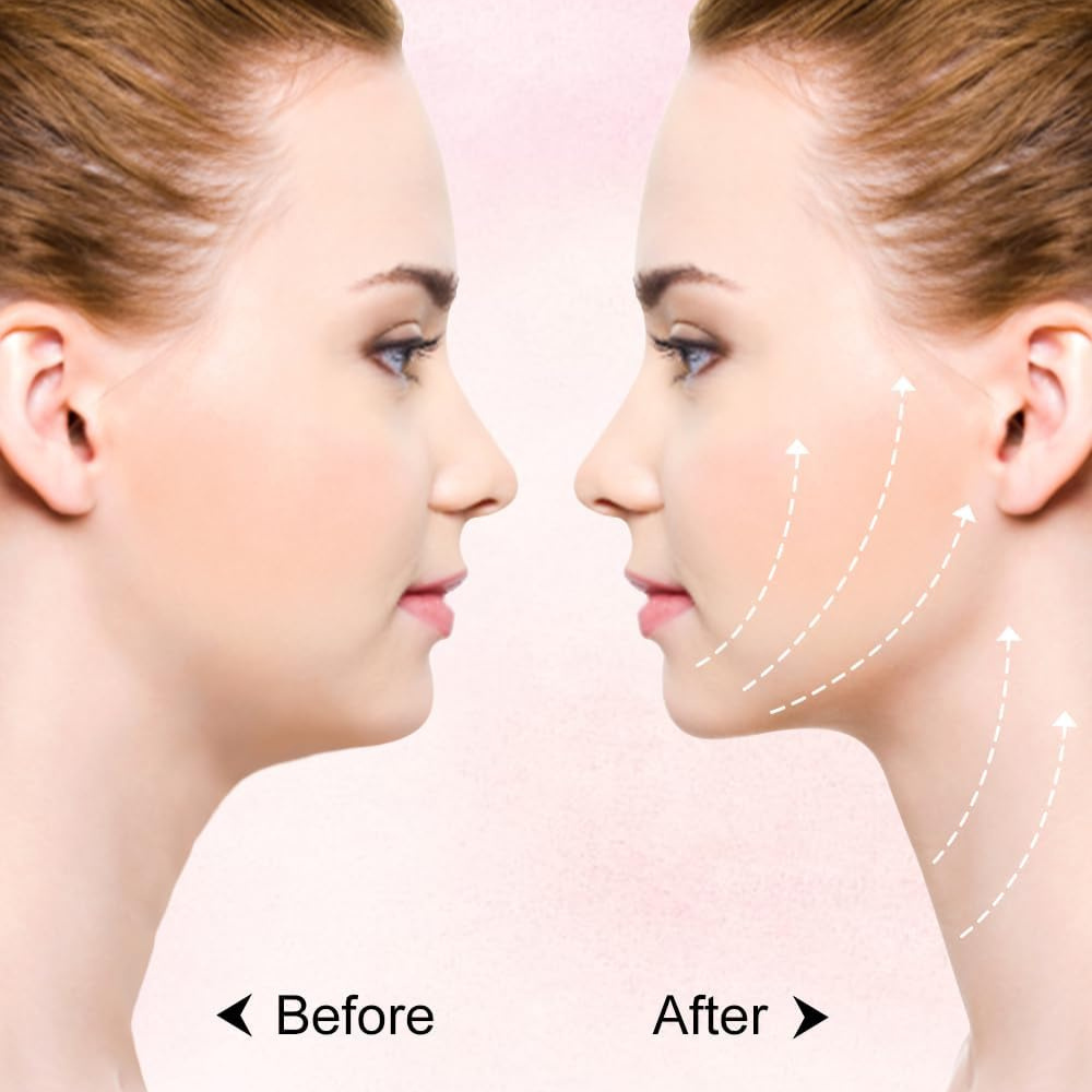 VShape™ | Face Slimming Strap