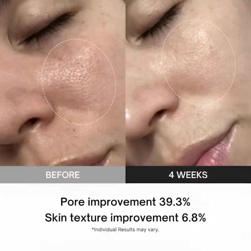Dermax™ | Booster Facial Therapy