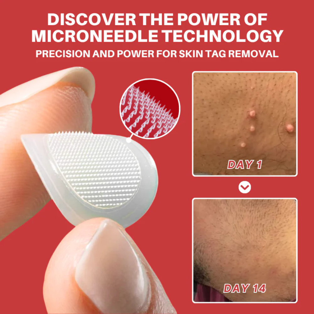 RenewTag™ | Skintag Removal Patches