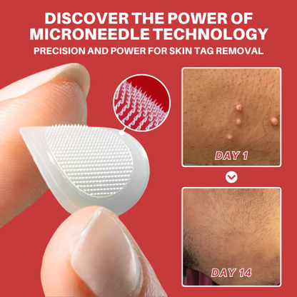 RenewTag™ | Skintag Removal Patches