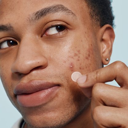 ClearDot™ | Invisible Pimple Patch