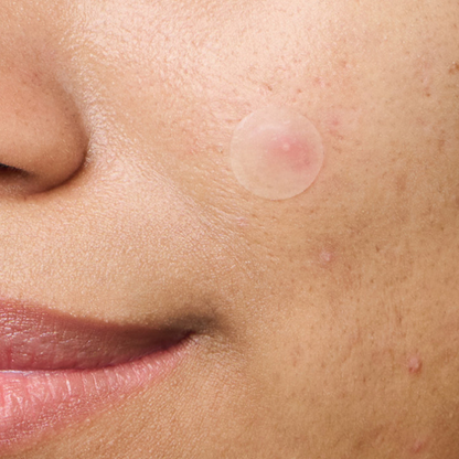 ClearDot™ | Invisible Pimple Patch