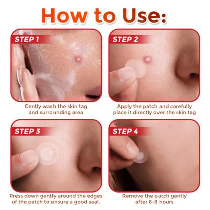 RenewTag™ | Skintag Removal Patches