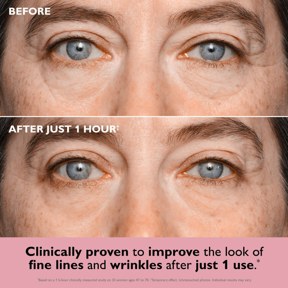 Refresh&Hydra™ | Collagen Eye Patches