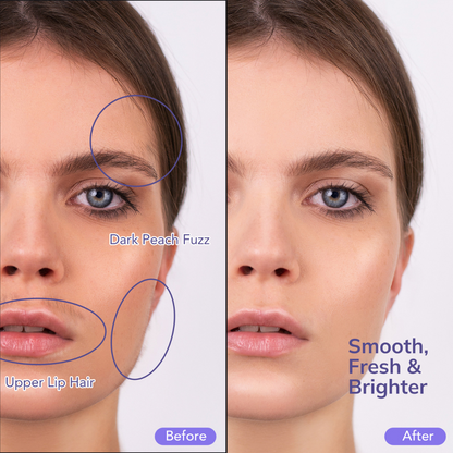 Dermexa™ | Sonic Dermaplaning Tool