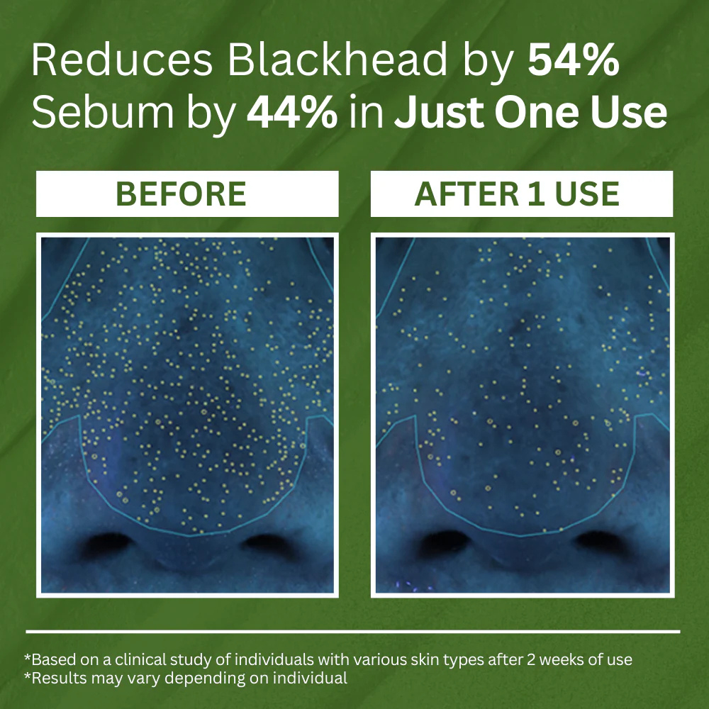 Herbora™ | Basil Sparking Bubble Mask