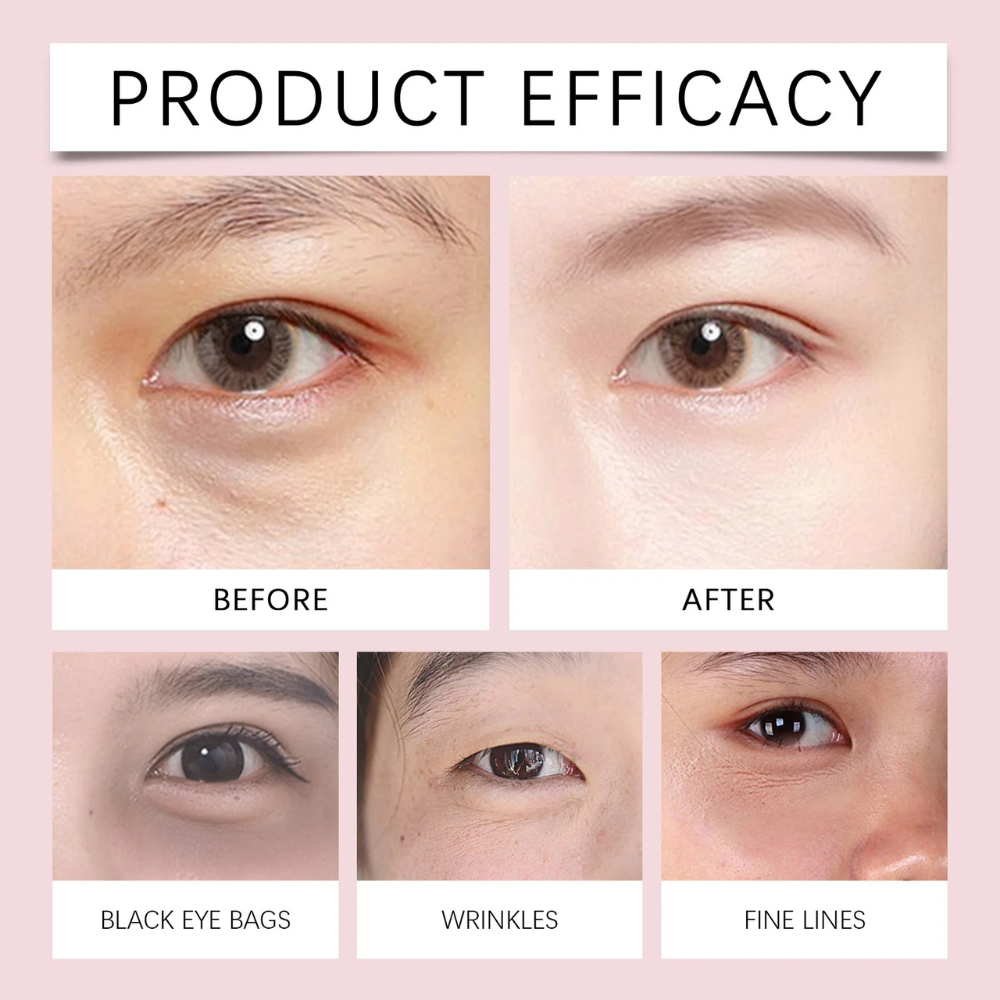 VibraLift™ | Electric Massage Eye Cream