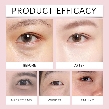 VibraLift™ | Electric Massage Eye Cream