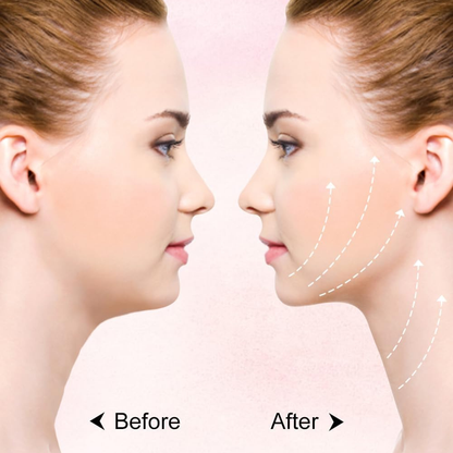 VShape™ | Face Slimming Strap