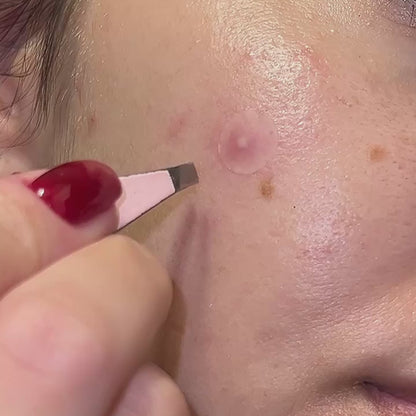 ClearDot™ | Invisible Pimple Patch